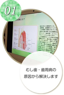 むし歯・歯周病の原因から解決します
